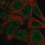 Merck Anti-SKIV2L antibody produced in rabbit