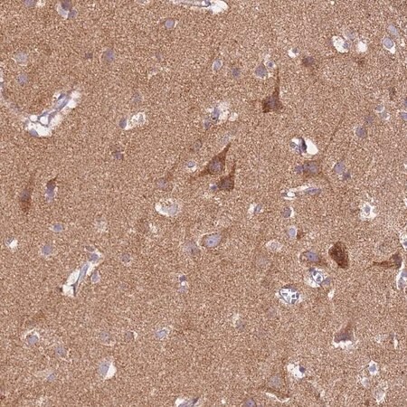 Merck Anti-PROKR2 antibody produced in rabbit