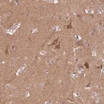 Merck Anti-PROKR2 antibody produced in rabbit