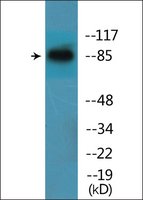 Merck ANTI-PHOSPHO-CATENIN-BETA (PTYR654)