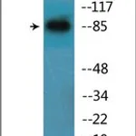 Merck ANTI-PHOSPHO-CATENIN-BETA (PTYR654)