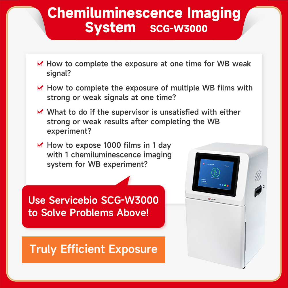 Servicebio Chemiluminescence Imaging System