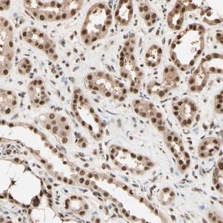 Merck Anti-HSF1 antibody produced in rabbit