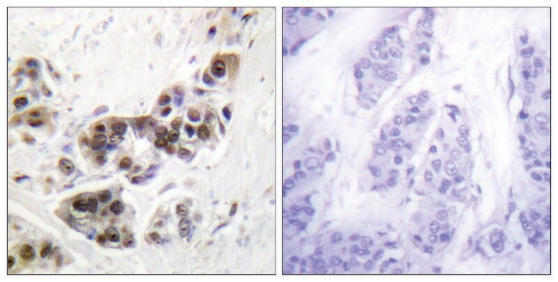 Merck Anti-p53 antibody produced in rabbit