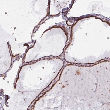 Merck Anti-MAGT1 antibody produced in rabbit