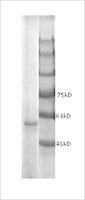 Merck CETP, HUMAN