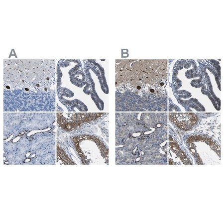 Merck Anti-STIM1 antibody produced in rabbit