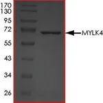 Merck MYLK4, ACTIVE