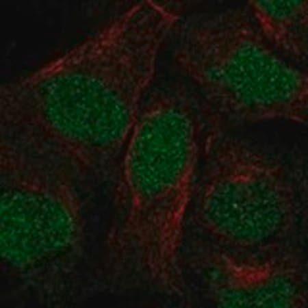 Merck Anti-ANKRD20A3P antibody produced in rabbit
