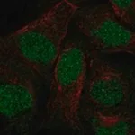 Merck Anti-ANKRD20A3P antibody produced in rabbit
