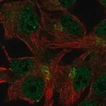 Merck Anti-C11ORF24 antibody produced in rabbit