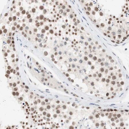 Merck Anti-SAP18 antibody produced in rabbit