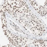 Merck Anti-SAP18 antibody produced in rabbit