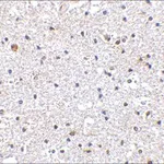 Merck ANTI-PD-1 (AB1)