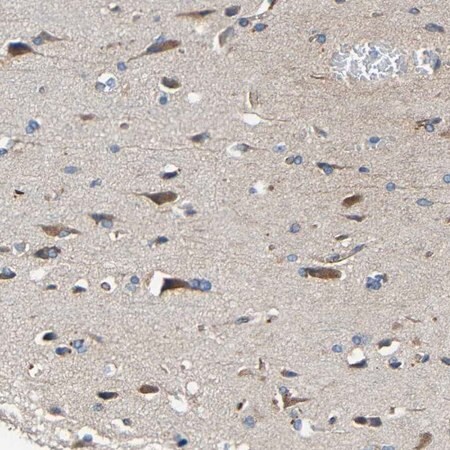 Merck Anti-RHOT2 antibody produced in rabbit
