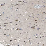 Merck Anti-RHOT2 antibody produced in rabbit