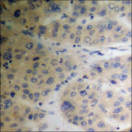 Merck Anti-phospho-TIP60 (pSer86) antibody produced in rabbit