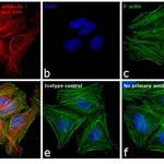 Thermo Fisher Scientific Goat anti-Mouse IgG (H+L) Highly Cross-Adsorbed Secondary Antibody, Alexa Fluor 594