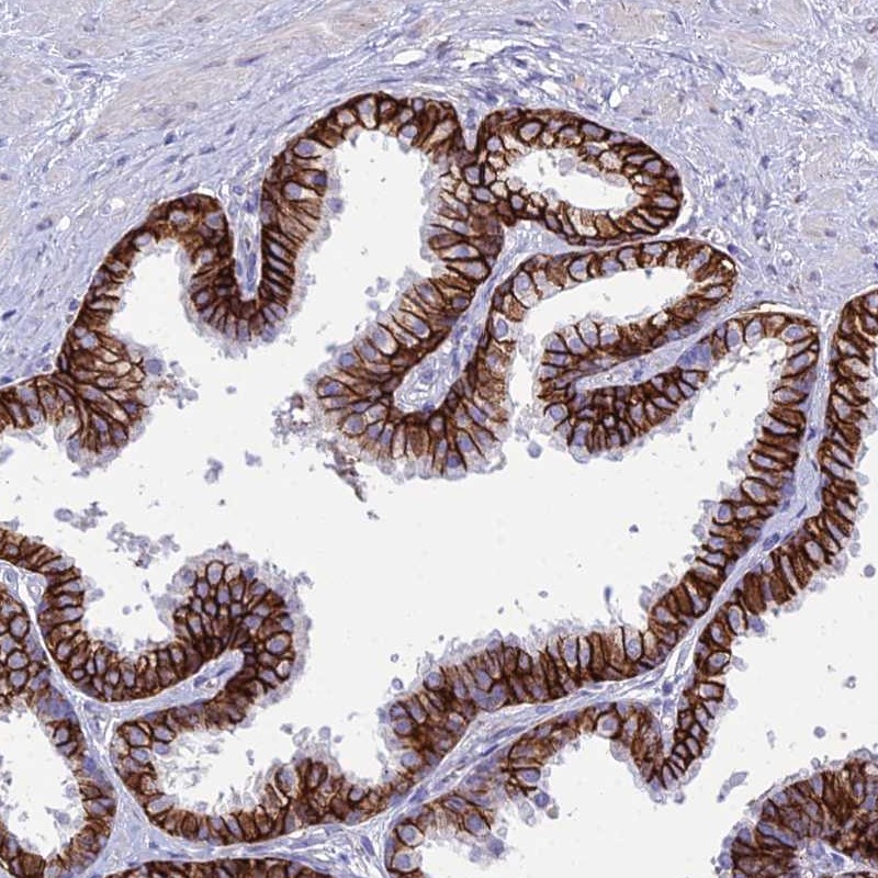 Atlas Antibodies Anti-OR1Q1 Antibody