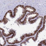 Atlas Antibodies Anti-OR1Q1 Antibody
