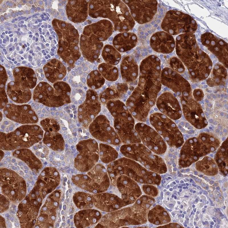 Atlas Antibodies Anti-OR1S2 Antibody
