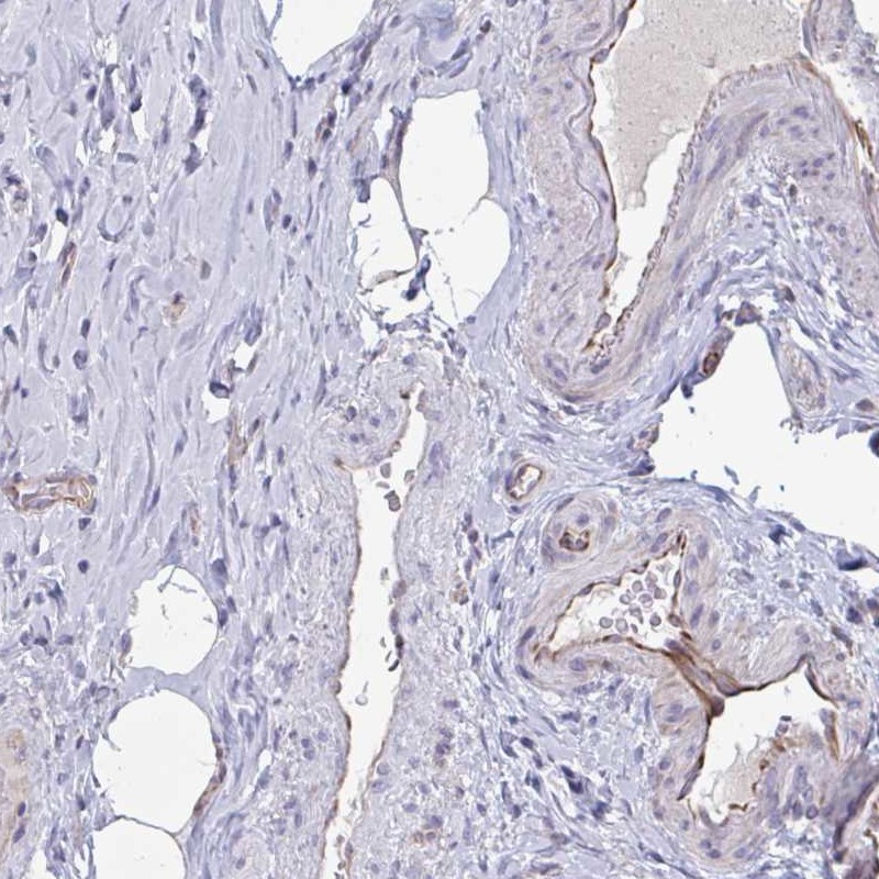 Atlas Antibodies Anti-OR1L3 Antibody