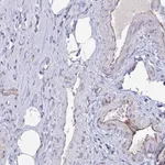 Atlas Antibodies Anti-OR1L3 Antibody