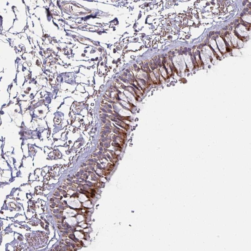 Atlas Antibodies Anti-OR2D3 Antibody