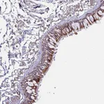Atlas Antibodies Anti-OR2D3 Antibody