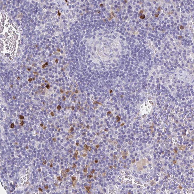 Atlas Antibodies Anti-OR2A4 Antibody