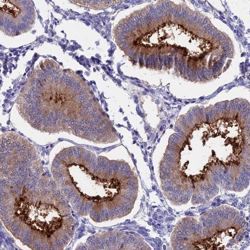 Atlas Antibodies Anti-OR2AE1 Antibody