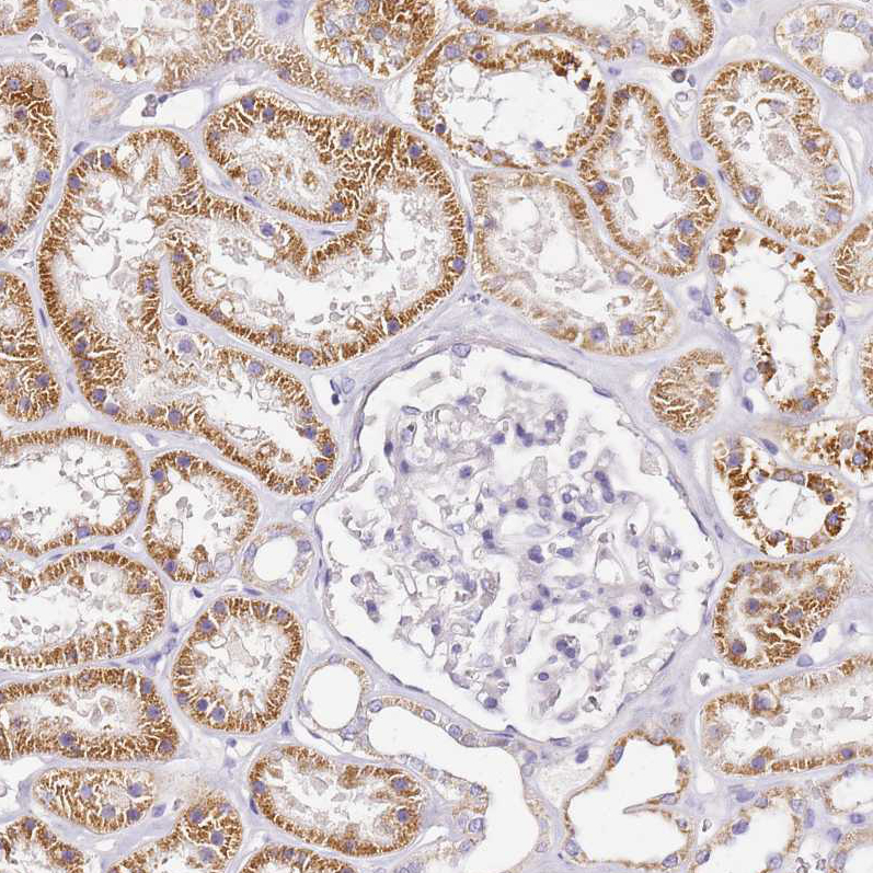 Atlas Antibodies Anti-OR2B11 Antibody