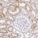 Atlas Antibodies Anti-OR2B11 Antibody