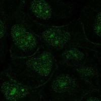 Atlas Antibodies Anti-OR1N2 Antibody
