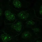 Atlas Antibodies Anti-OR1N2 Antibody