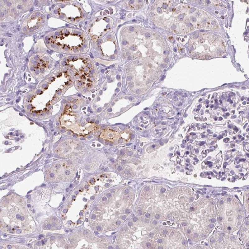 Atlas Antibodies Anti-OR2AK2 Antibody