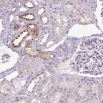 Atlas Antibodies Anti-OR2AK2 Antibody