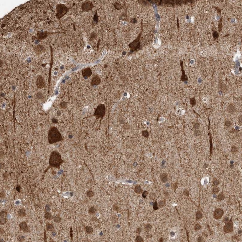 Atlas Antibodies Anti-OR2K2 Antibody