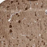 Atlas Antibodies Anti-OR2K2 Antibody