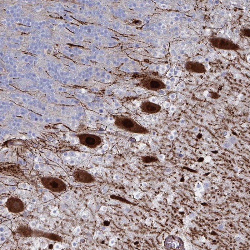 Atlas Antibodies Anti-OR2T1 Antibody