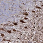 Atlas Antibodies Anti-OR2T1 Antibody
