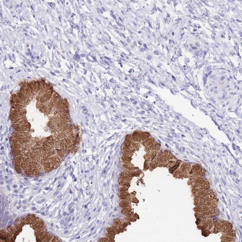 Atlas Antibodies Anti-OR2Z1 Antibody
