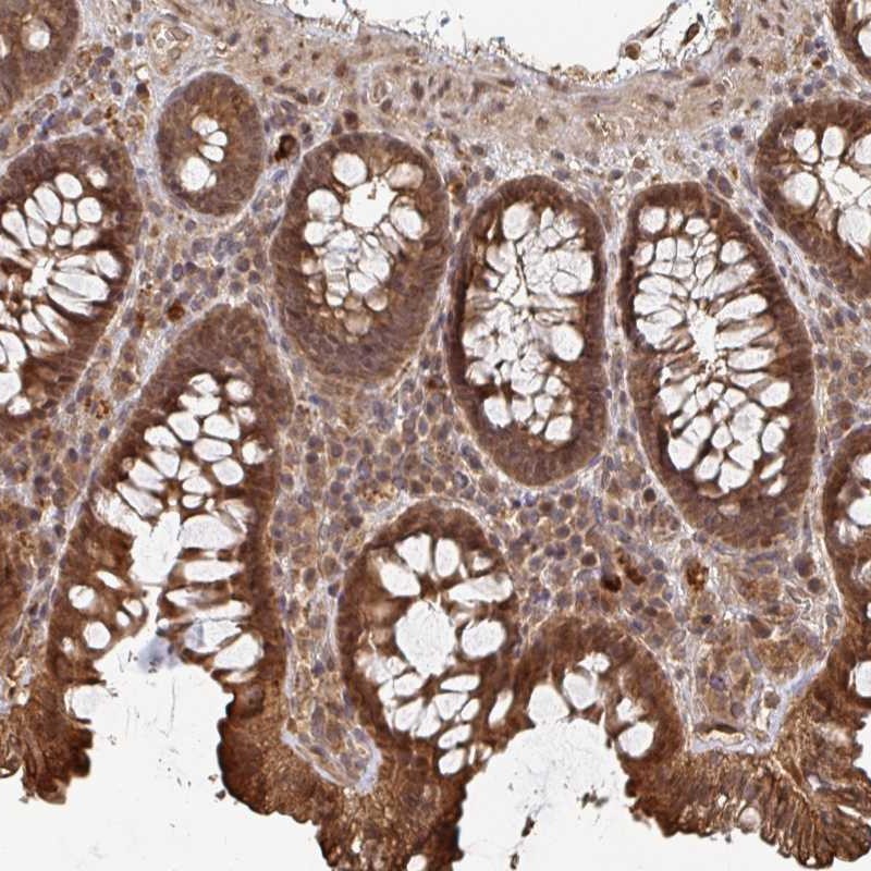 Atlas Antibodies Anti-OR4C15 Antibody