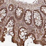 Atlas Antibodies Anti-OR4C15 Antibody