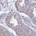 Atlas Antibodies Anti-OR2W3 Antibody