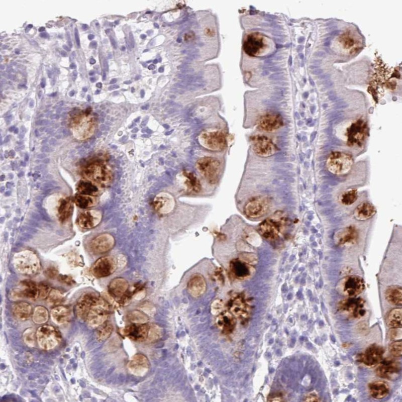 Atlas Antibodies Anti-OR2T10 Antibody