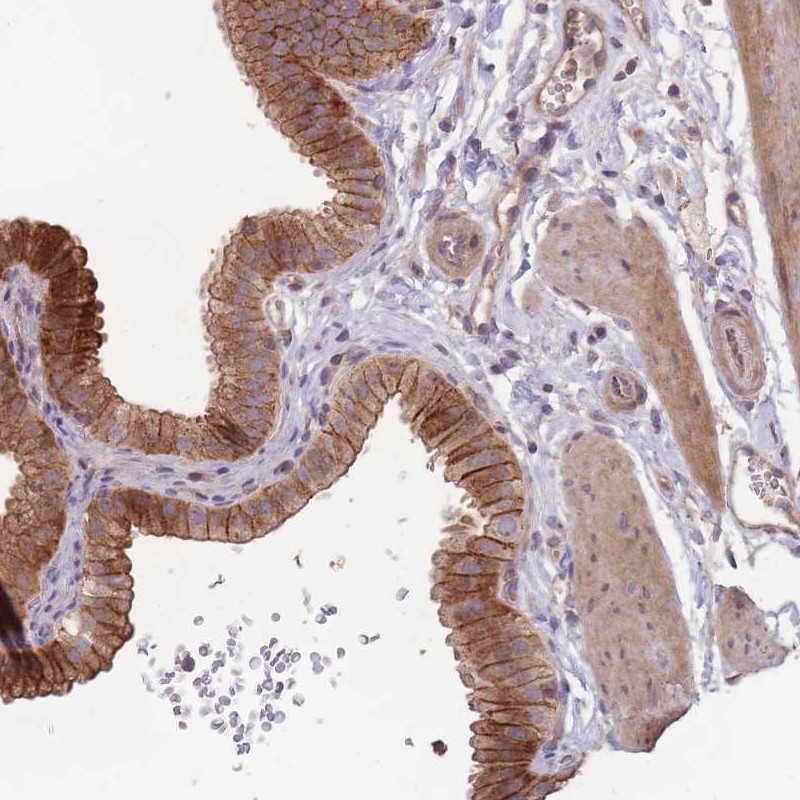 Atlas Antibodies Anti-OR4C3 Antibody