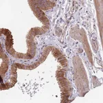 Atlas Antibodies Anti-OR4C3 Antibody