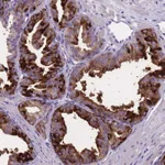 Atlas Antibodies Anti-OR4C5 Antibody