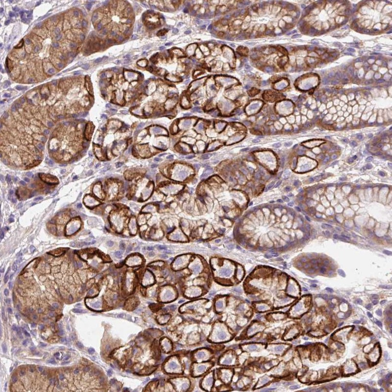 Atlas Antibodies Anti-OR4K15 Antibody